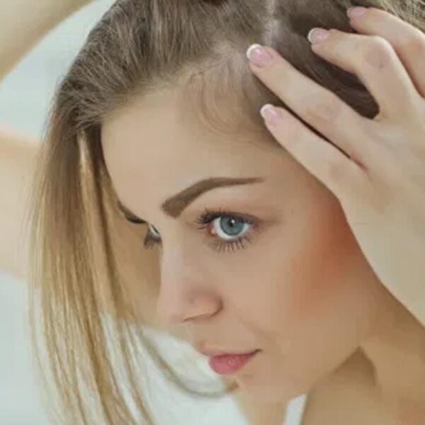 Best Foods for Hair Loss Recovery